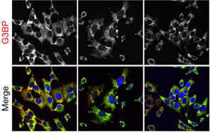 《Nature》細胞的應激反應比科學家認為的更細微、更分散