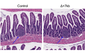 Nature：科學家新發(fā)現(xiàn)一種免疫細胞類型，與過敏有關(guān)