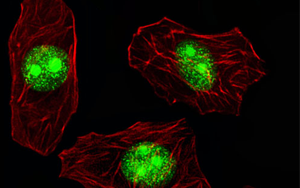 細(xì)胞表面的RNA結(jié)合蛋白是對抗癌癥的關(guān)鍵