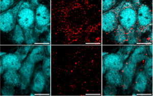 重大發(fā)現(xiàn)！阿爾茨海默病患者來源的高分子量 tau 蛋白如何 “破壞” 海馬神經(jīng)元？