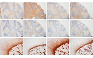 揭秘溶酶體關鍵酶 PLA2G15：靶向治療溶酶體疾病的新希望