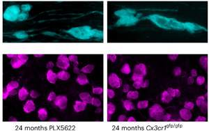 《Nature Neuroscience》大腦白質為何隨年齡退化？因為免疫細胞“勾心斗角”