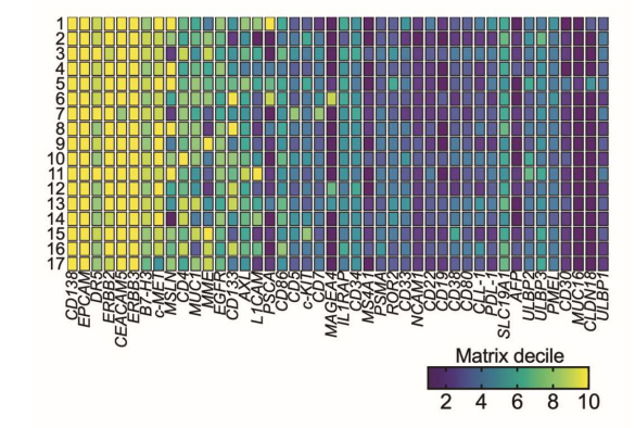 上皮細胞CAR抗原在結直腸癌肝轉移患者樣本中表達 上皮細胞CAR抗原在結直腸癌肝轉移患者樣本中表達