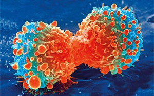 Nature Genetics：腫瘤轉移過程中會積累更多的拷貝數變異，而不是突變