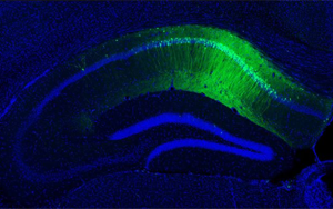 5-羥色胺(5-HT)通過調節腸道菌群-免疫軸改善加速度暴露誘導的大鼠腸腦軸功能障礙及認知損傷