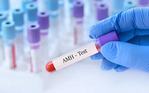 抗繆勒管激素（AMH）-磁微粒化學(xué)發(fā)光法（AE/AP） +熒光免疫層析解決方案