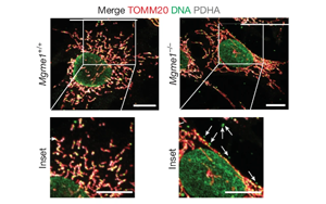 核糖核苷酸滲入線粒體DNA驅動炎癥反應——揭示核苷酸代謝失衡引發年齡相關性炎癥的新機制