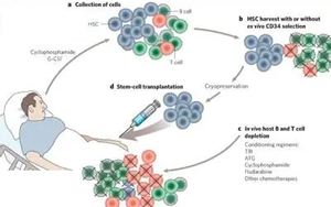 自體造血干細胞移植時S期殘留克隆性漿細胞對多發性骨髓瘤臨床預后的影響研究