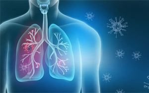 呼吸道感染病原體檢測高品質原料推薦