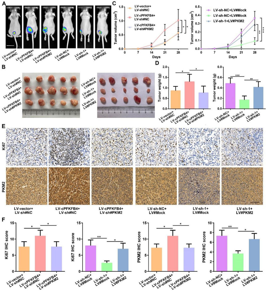 cPFKFB4通過PKM2促進胰腺癌惡性進展 cPFKFB4通過PKM2促進胰腺癌惡性進展