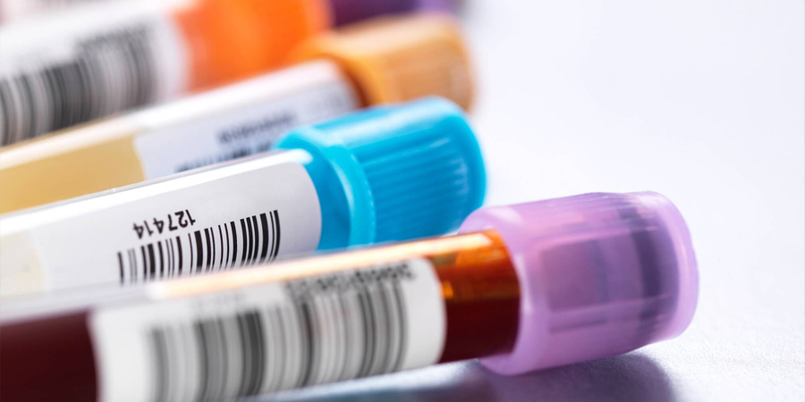 前蛋白檢測 前蛋白檢測