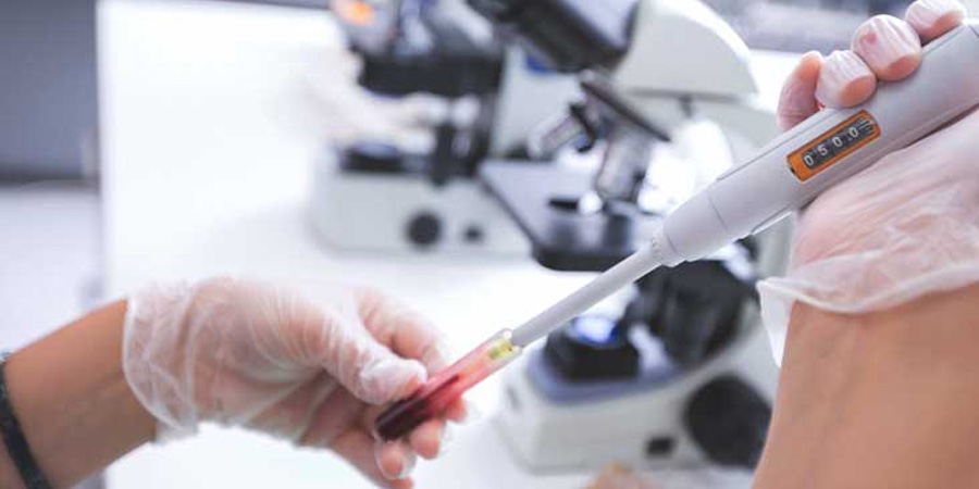 肌紅蛋白(MYO)檢測 肌紅蛋白(MYO)檢測