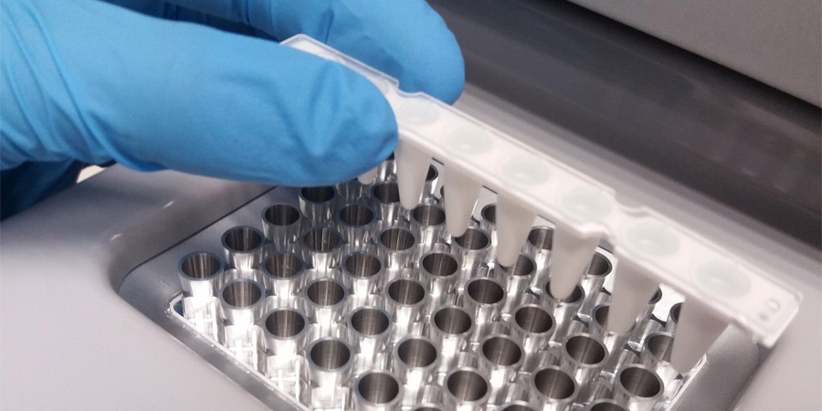 銅藍蛋白檢測 銅藍蛋白檢測