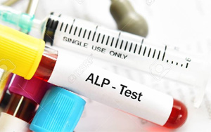 堿性磷酸酶（ALP/AKP）檢測試劑盒用原輔料