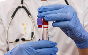 肌酸激酶同工酶（CK-MB）-磁微?；瘜W法學發(fā)光（AE/AP） /熒光免疫層析解決方案