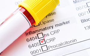 C-反應蛋白（CRP）-熒光免疫層析解決方案