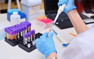 可溶性生長刺激表達基因2蛋白（ST2）- 磁微粒化學發光法（吖啶酯）/熒光免疫層析解決方案