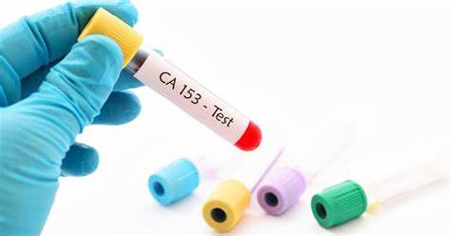 HP免疫層析 HP免疫層析