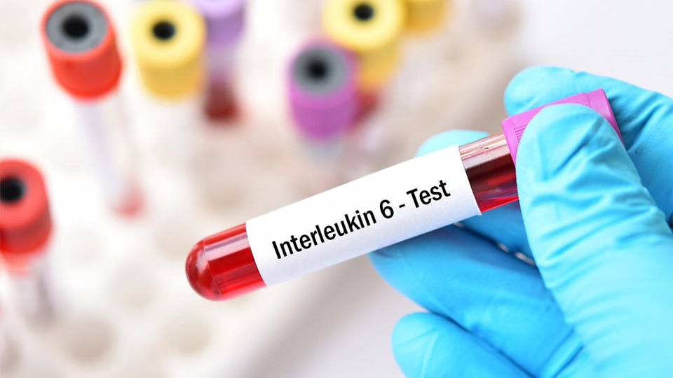 IL-6磁微粒化學發光熒光免疫層析 IL-6磁微粒化學發光熒光免疫層析