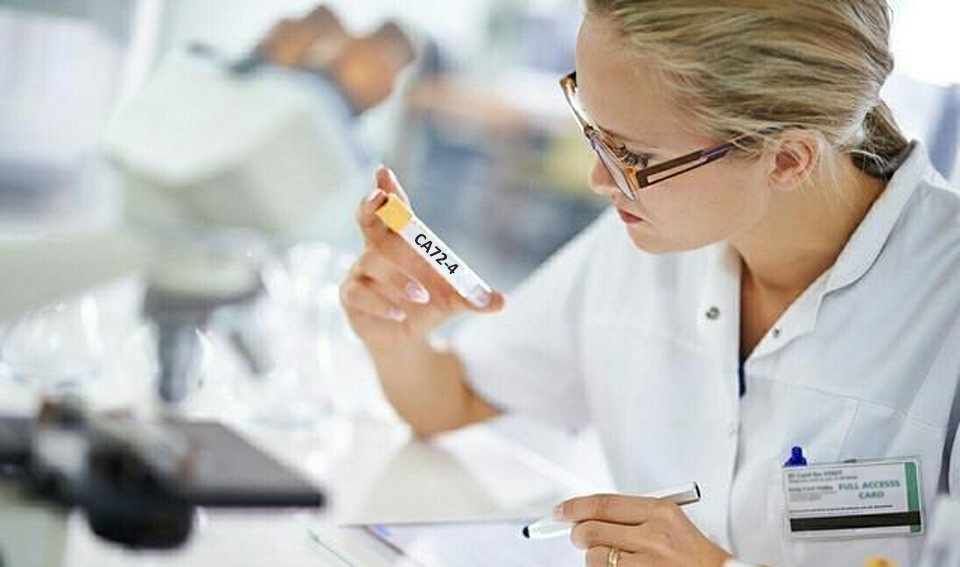 糖類抗原72-4(CA72-4)-磁微粒化學發光(吖啶酯)
解決方案 糖類抗原72-4(CA72-4)-磁微粒化學發光(吖啶酯)
解決方案